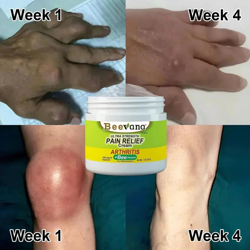 Bee Venom Ultra Strength Pain Relief Cream 100gram (Pack of 2)